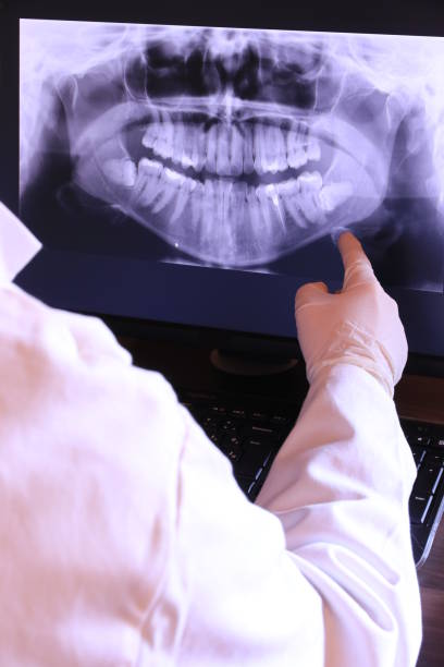 Best Emergency Dental Surgery in Dale, IN