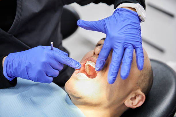 Best Emergency Tooth Extraction in Dale, IN